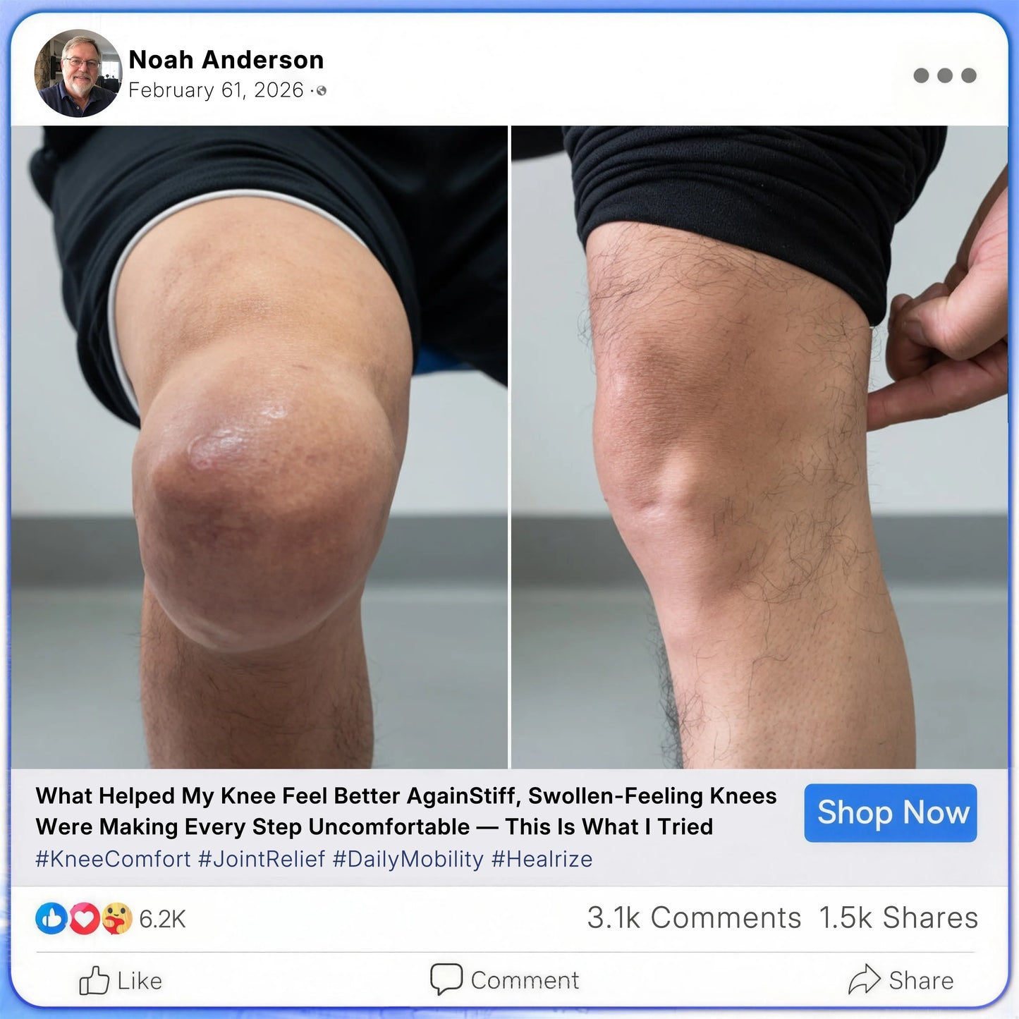 [cs-1] Healrize® Bee Venom Joint Relief Cream 🦵Powerful Bee Venom Cream for Joint & Muscle Pain Relief – Feel Comfort in Minutes
