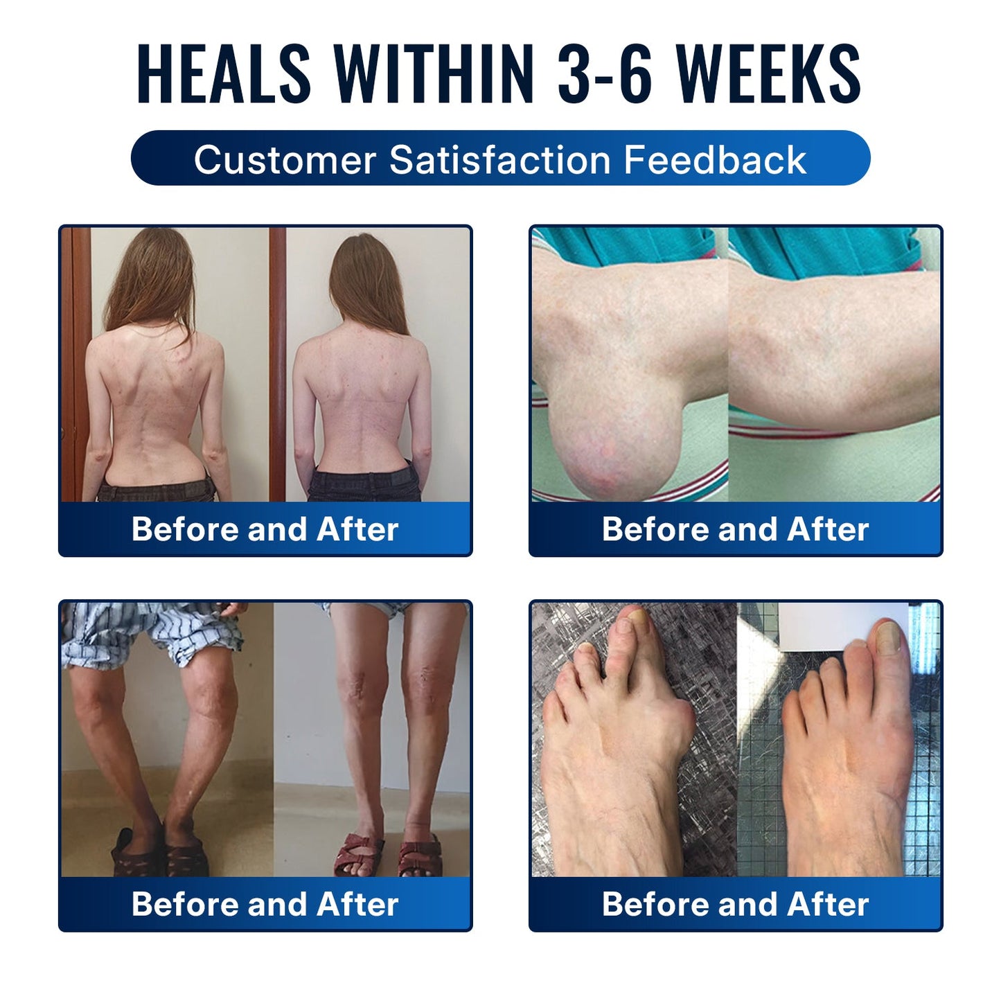 🎁Healrize® Bee Venom Joint Relief Cream 💪Targets stiff, sore joints in knees, hands, shoulders, back & more — so you can move easier every day