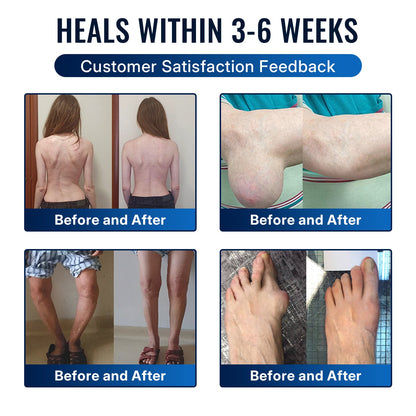 🎁Healrize® Bee Venom Joint Relief Cream 💪Targets stiff, sore joints in knees, hands, shoulders, back & more — so you can move easier every day