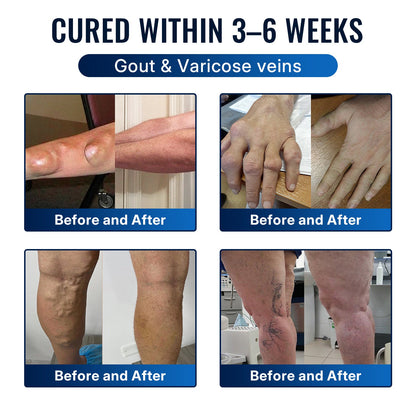 🎁Healrize® Bee Venom Joint Relief Cream 💪Targets stiff, sore joints in knees, hands, shoulders, back & more — so you can move easier every day