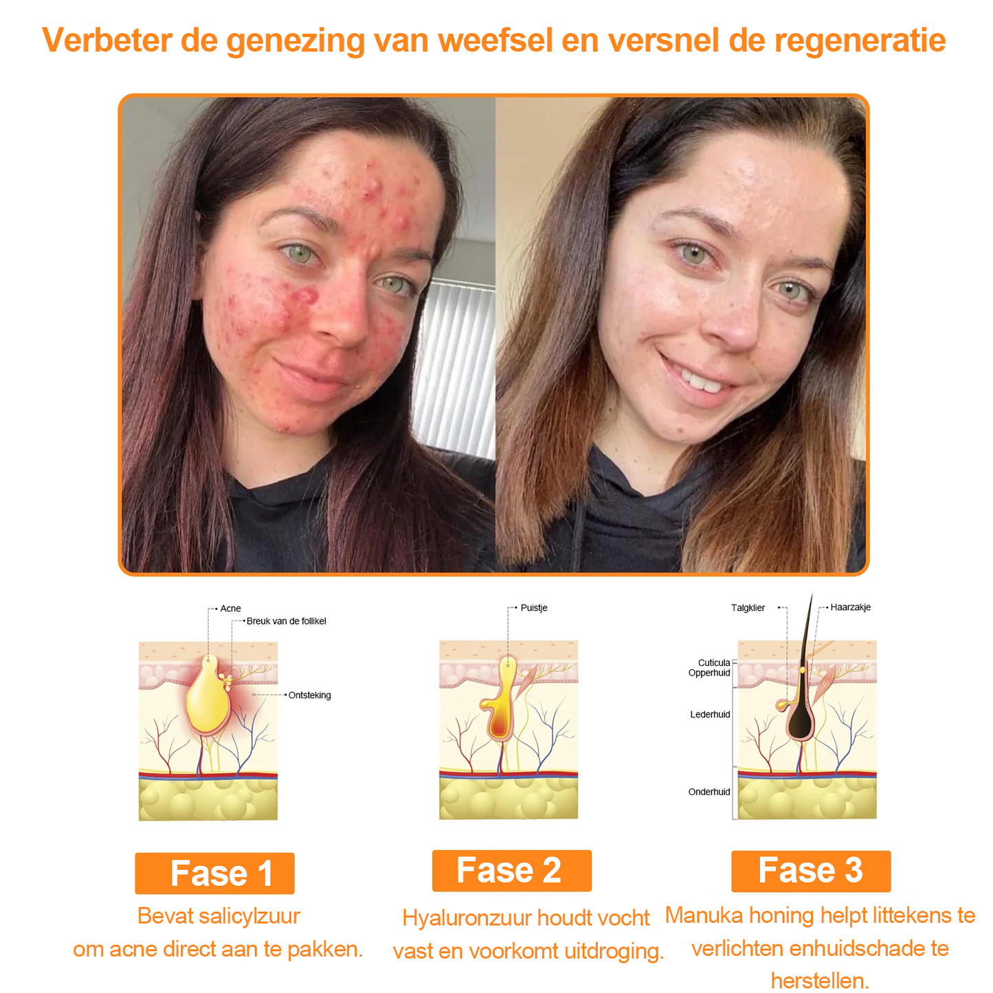 Turonu™ 7-daagse multi-effect alles-in-één huidverzorgingscrème (aanbevolen door de Nederlandse Vereniging voor Dermatologie en Venereologie - NVDV)👨‍⚕️⭐