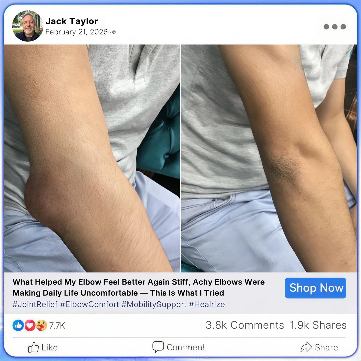 [cs-1] Healrize® Bee Venom Joint Relief Cream 🦵Powerful Bee Venom Cream for Joint & Muscle Pain Relief – Feel Comfort in Minutes